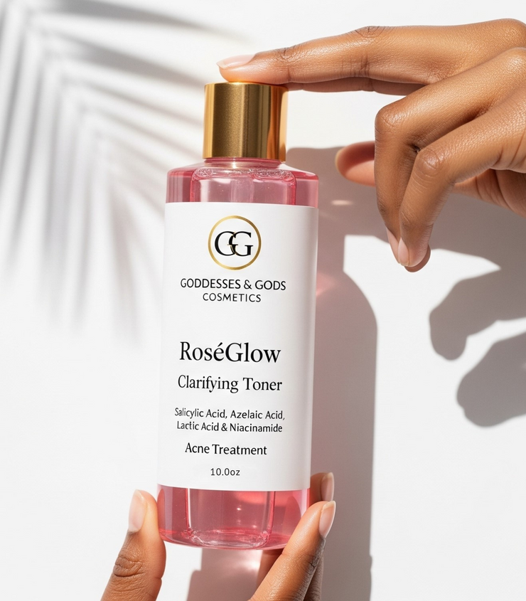 RoséGlow Clarifying Toner -Acne Treatment Toner